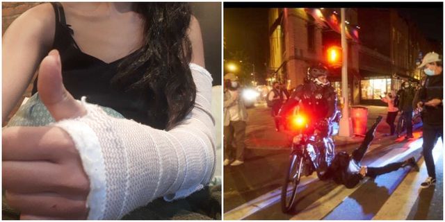 protester with broken arm